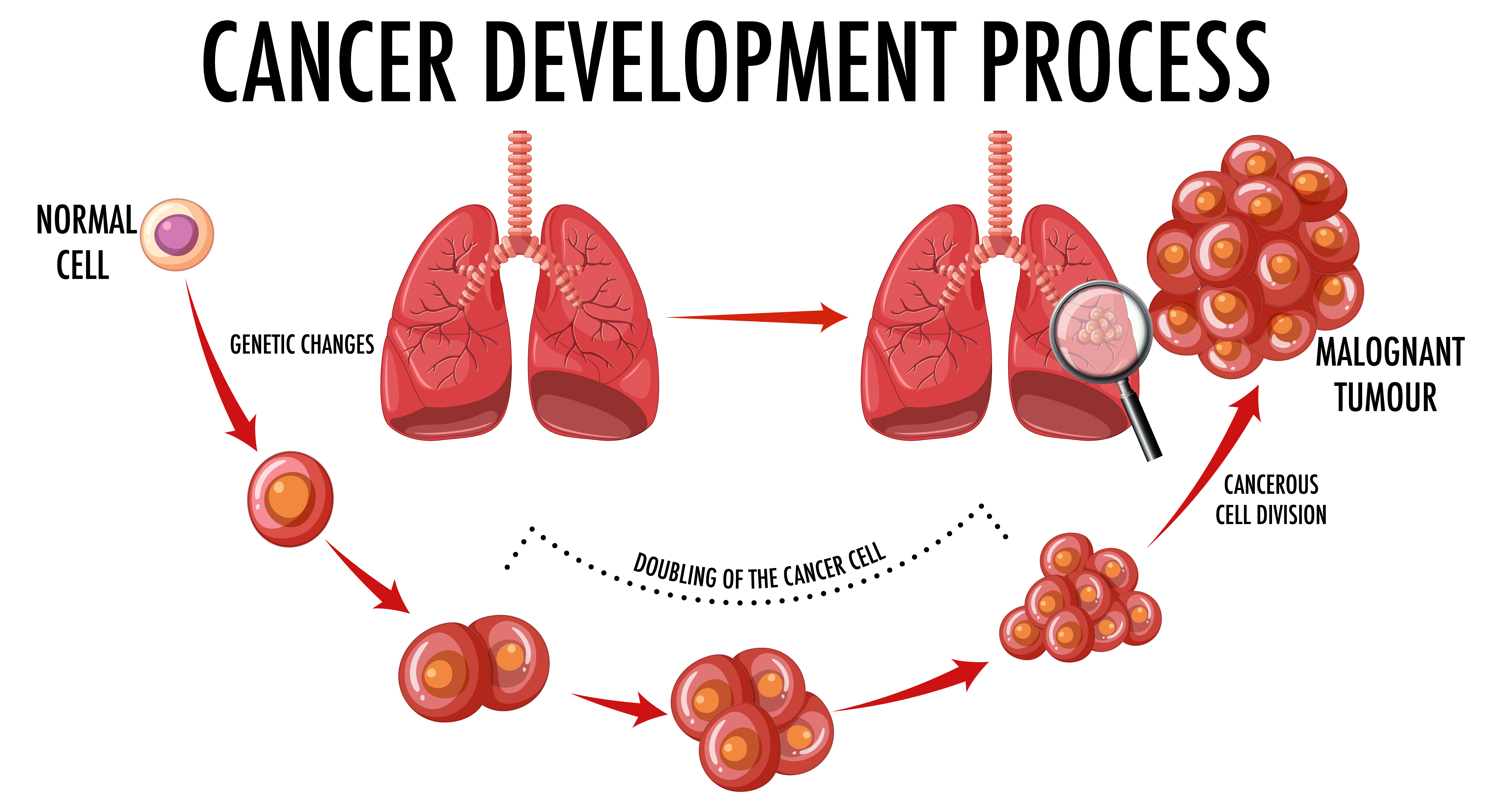 Tuberculosis new challenges